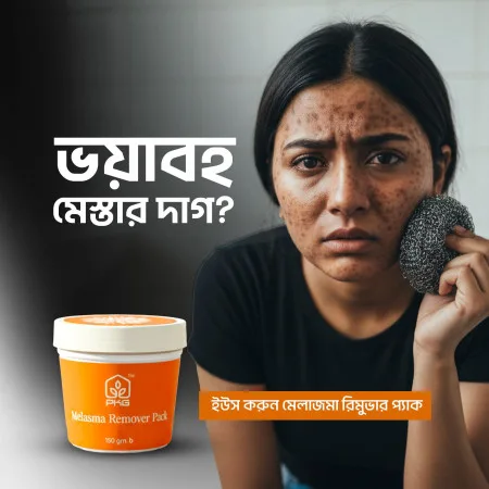 পিকেজি মেলাজমা রিমুভার প্যাক (PKG Melasma Remover Pack)