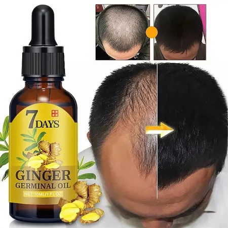 7 Days Ginger Hair Growth