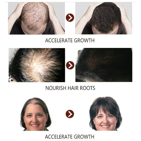 7 Days Ginger Hair Growth